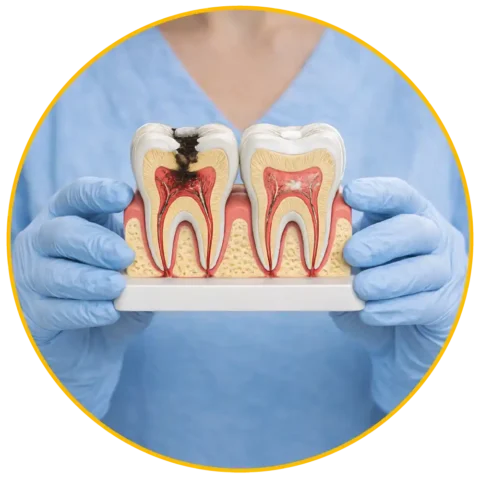 Pediatric dentist explaining cavity treatment and restorative dentistry for kids in Pembroke Pines Florida